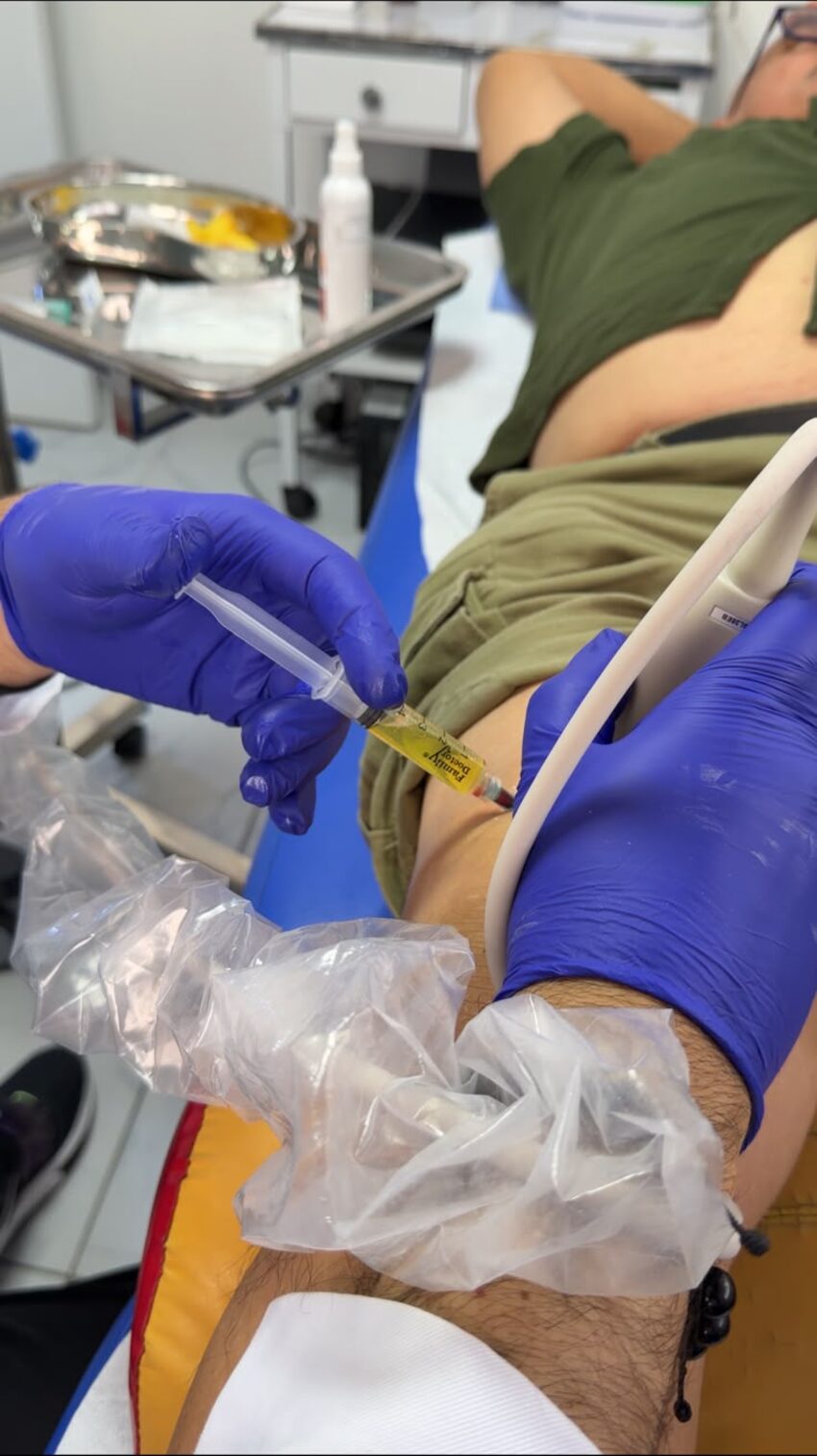 Dr. Falcón preparando plasma rico en plaquetas (PRP)